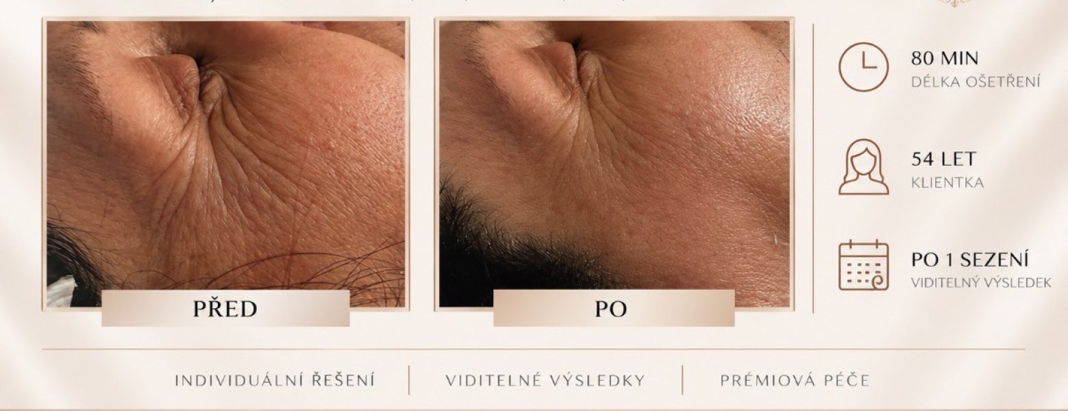 Před a po